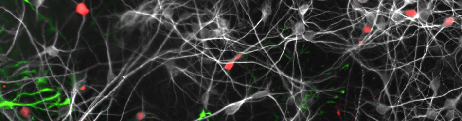 Image of neuronal cells from the brain.